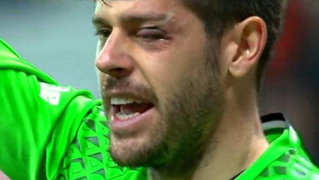 Fabri'nin gözü bu hale geldi! Alkışlarla kenara...